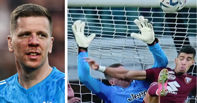 Szczesny përfundon në spital pas ndeshjes me Torinon