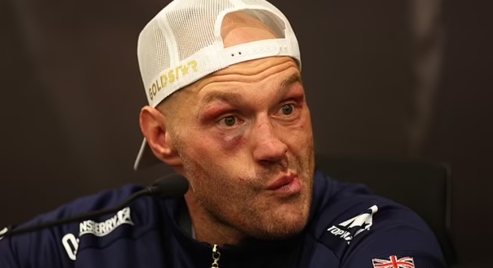 Fury përjashtohet nga boksi për kaq kohë, kjo është arsyeja