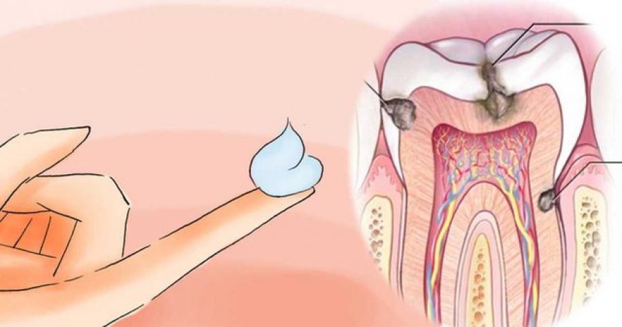 Rreziku dhe parandalimi ndaj sëmundjeve periodontale