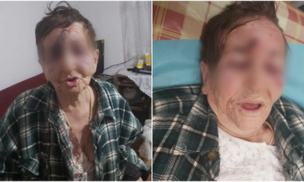 Shkodër: Nusja e rrah vjehrrën me shkop, arrestohet