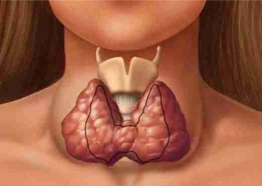 Roli i tiroides në rënien e flokëve dhe trajtimet natyrale që ju ndihmojnë