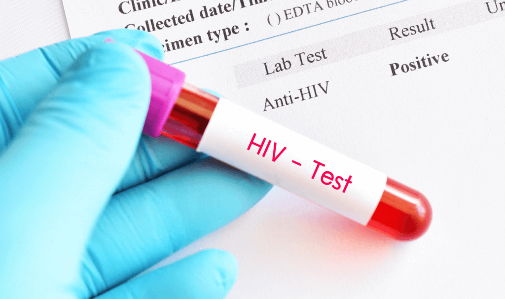 29 raste të reja me HIV janë regjistruar në Kosovë gjatë vitit 2024