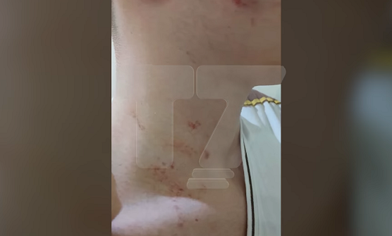 Një nxënës 16-vjeçar nga Prishtina pretendon se u rrah nga policët civilë në drejtori të shkollës