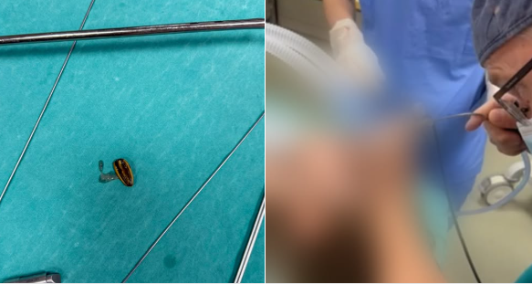 Shpëtohet jeta e 5-vjeçarit në QKUK, përpiu një farë të paqëruar