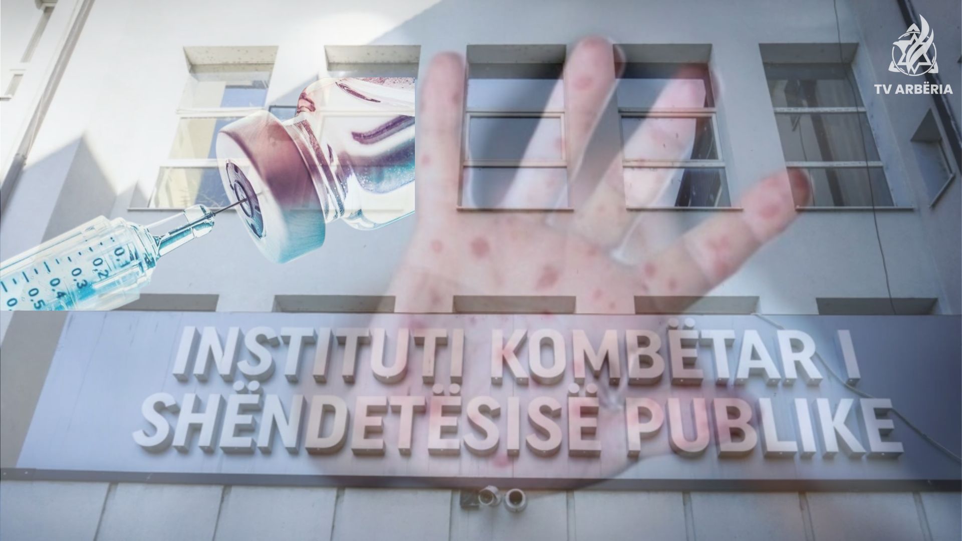 Fruthi në Kosovë, IKSHPK tregon komunat me shpërthime të lokalizuara në institucione parashkollore