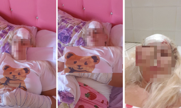 “Kafsha më ra, nëse lirohet jam e vdekur”, vajza nga Vushtrria rrëfen tmerrin që thotë se e përjetoi nga babai