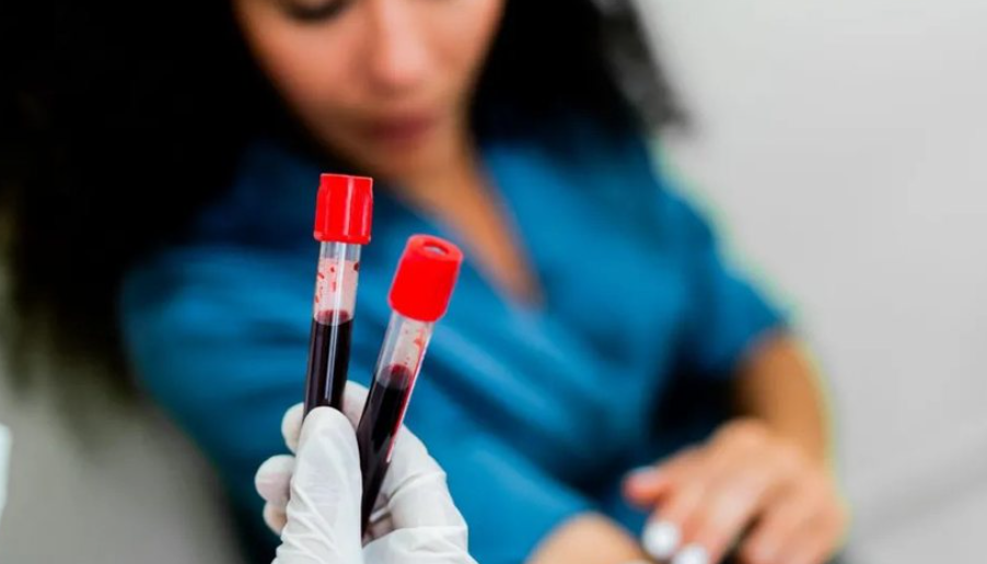 Një analizë e thjeshtë gjaku mund të zbulojë 50 lloje kanceri