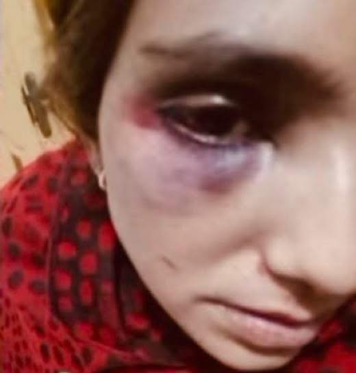 Dy vajza sulmojnë një grua në autobus pasi po hante gjatë Ramazanit