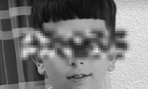 Vdes 13 vjeçari nga Kumanova pas goditjes nga makina derisa ishte me trotinet